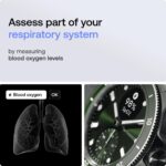 WITHINGS Scanwatch Nova - Reloj inteligente híbrido de salud cardíaca para hombres y mujeres, SPO2, monitoreo de tempera